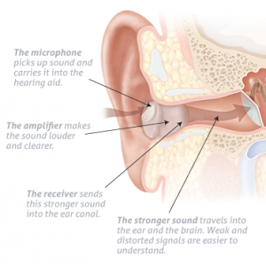 how-hearing-aids-work